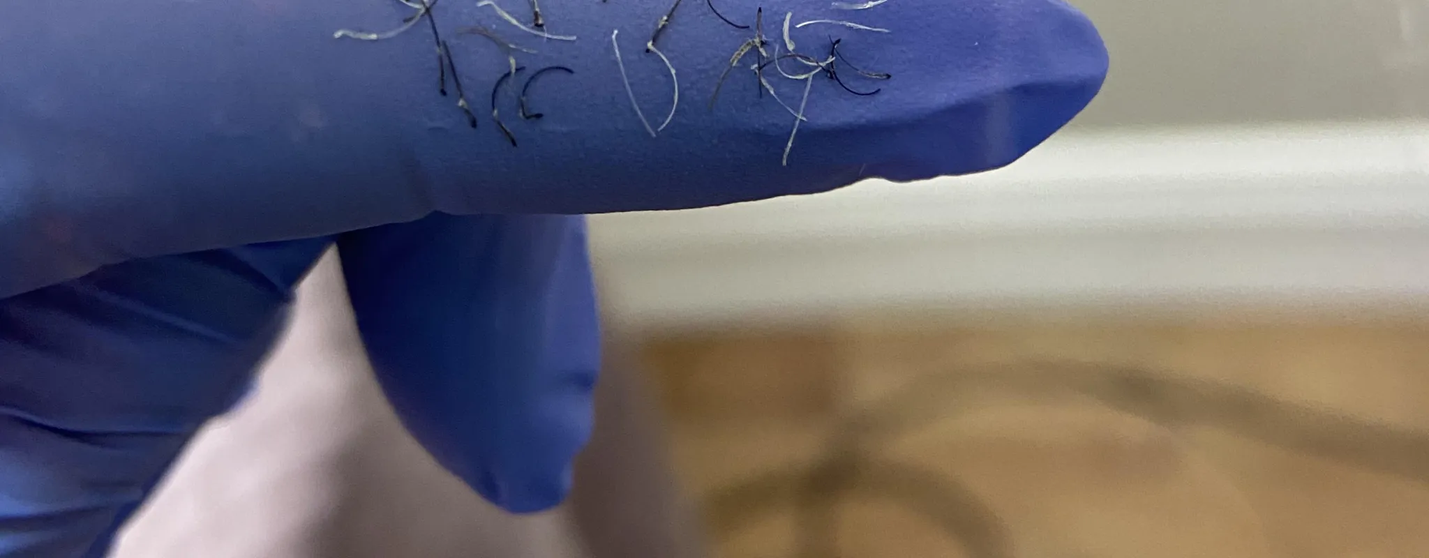 Hairs removed by electrolysis